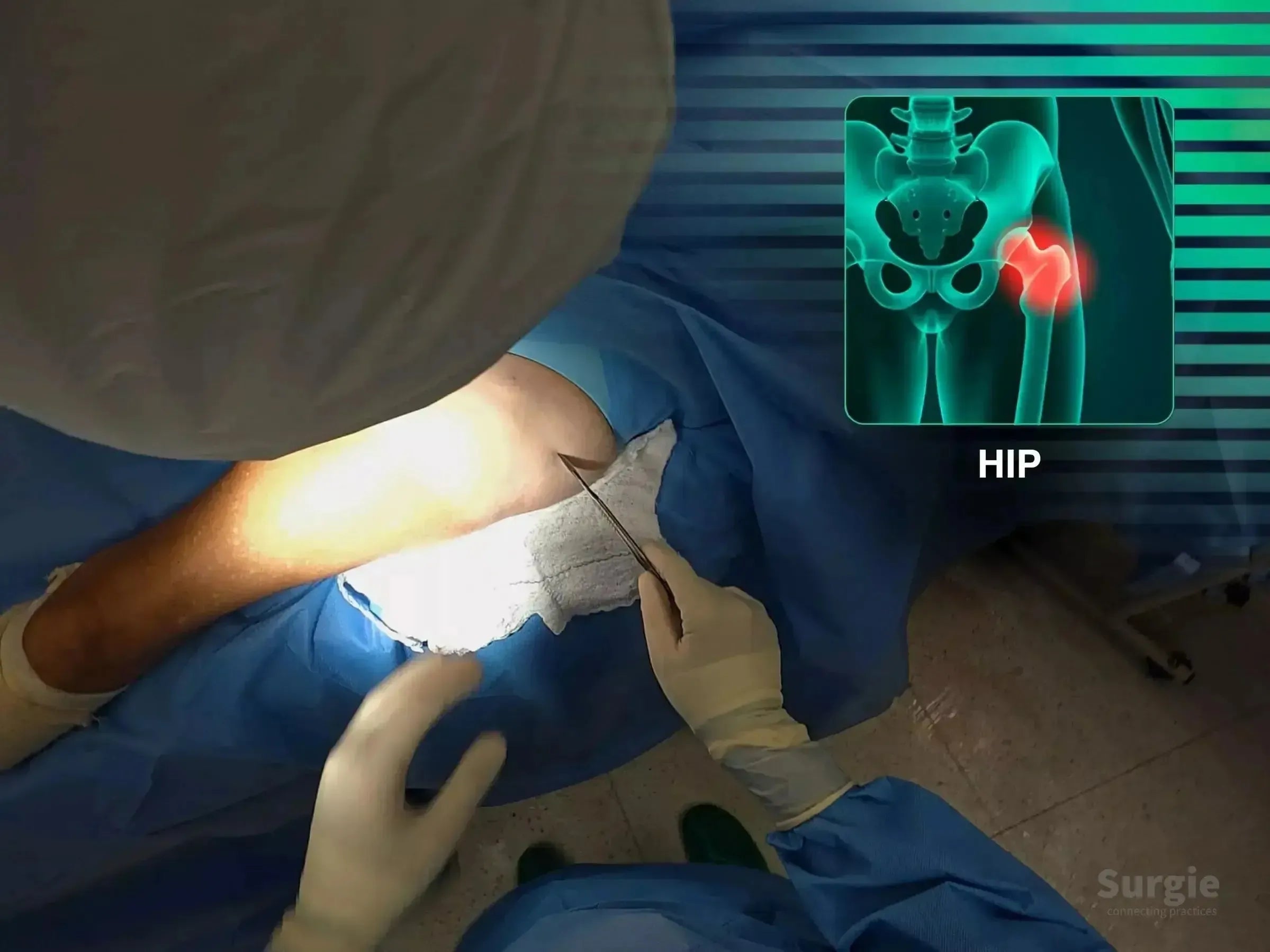 Surgeon performing a minimally invasive hip fracture procedure with a digital anatomical overlay of the femur.