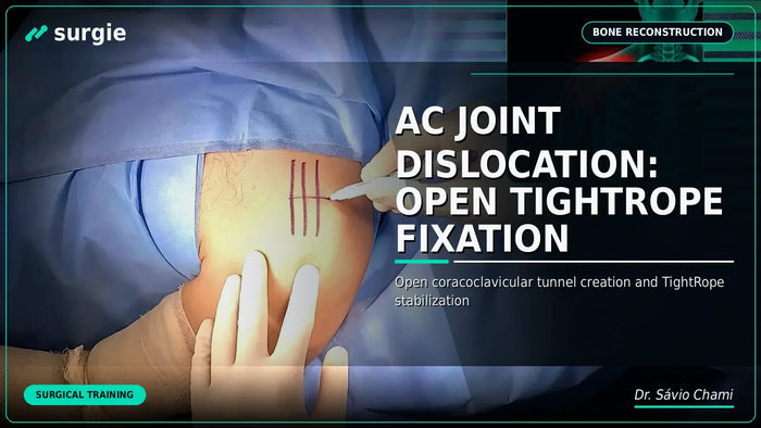 AC Joint Dislocation: Open TightRope Fixation