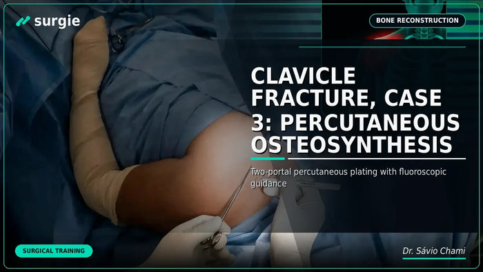 Clavicle Fracture, Case 3: Percutaneous Osteosynthesis