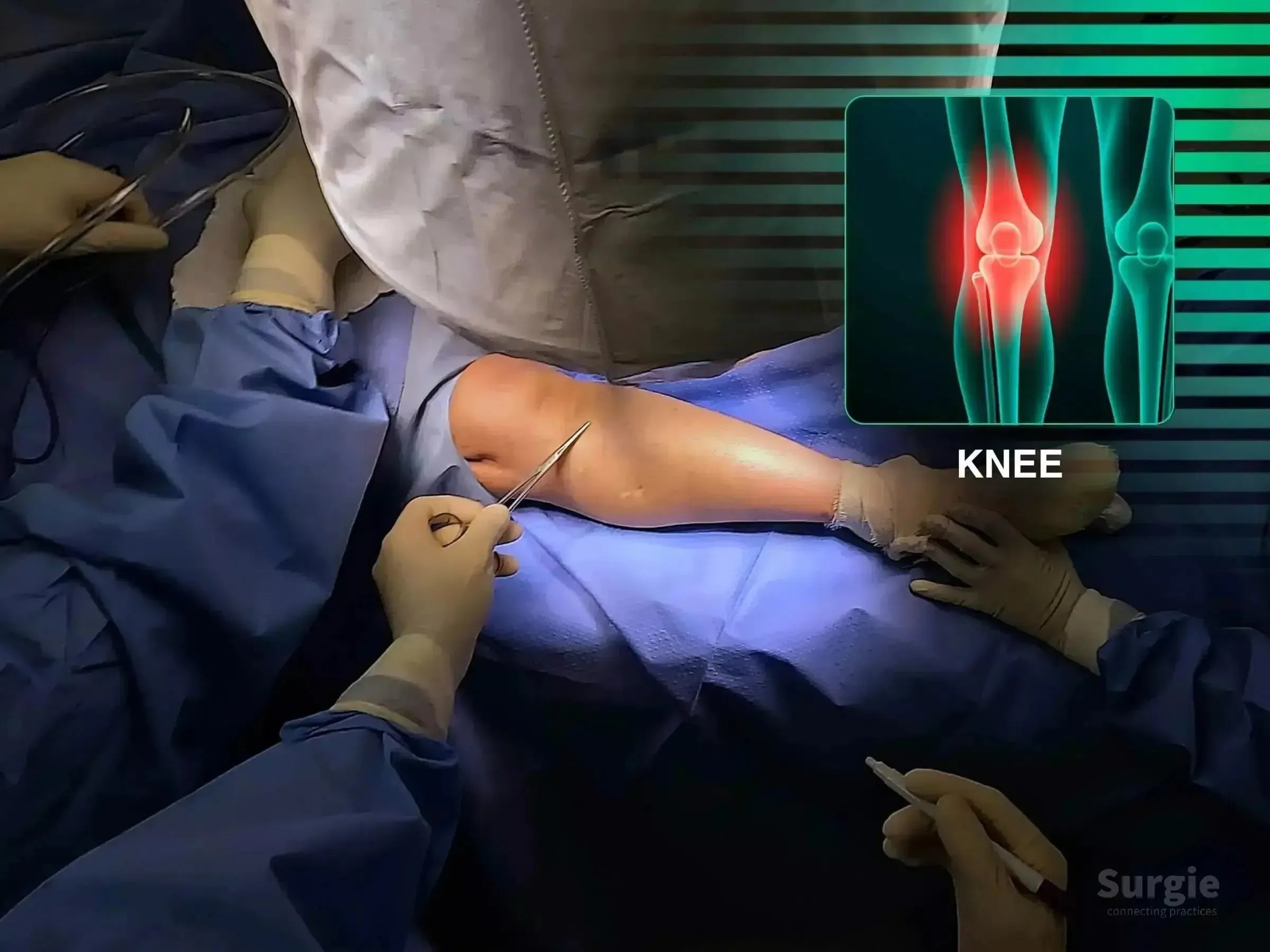 Surgeon performing minimally invasive tibia fracture surgery with anatomical knee diagram overlay.
