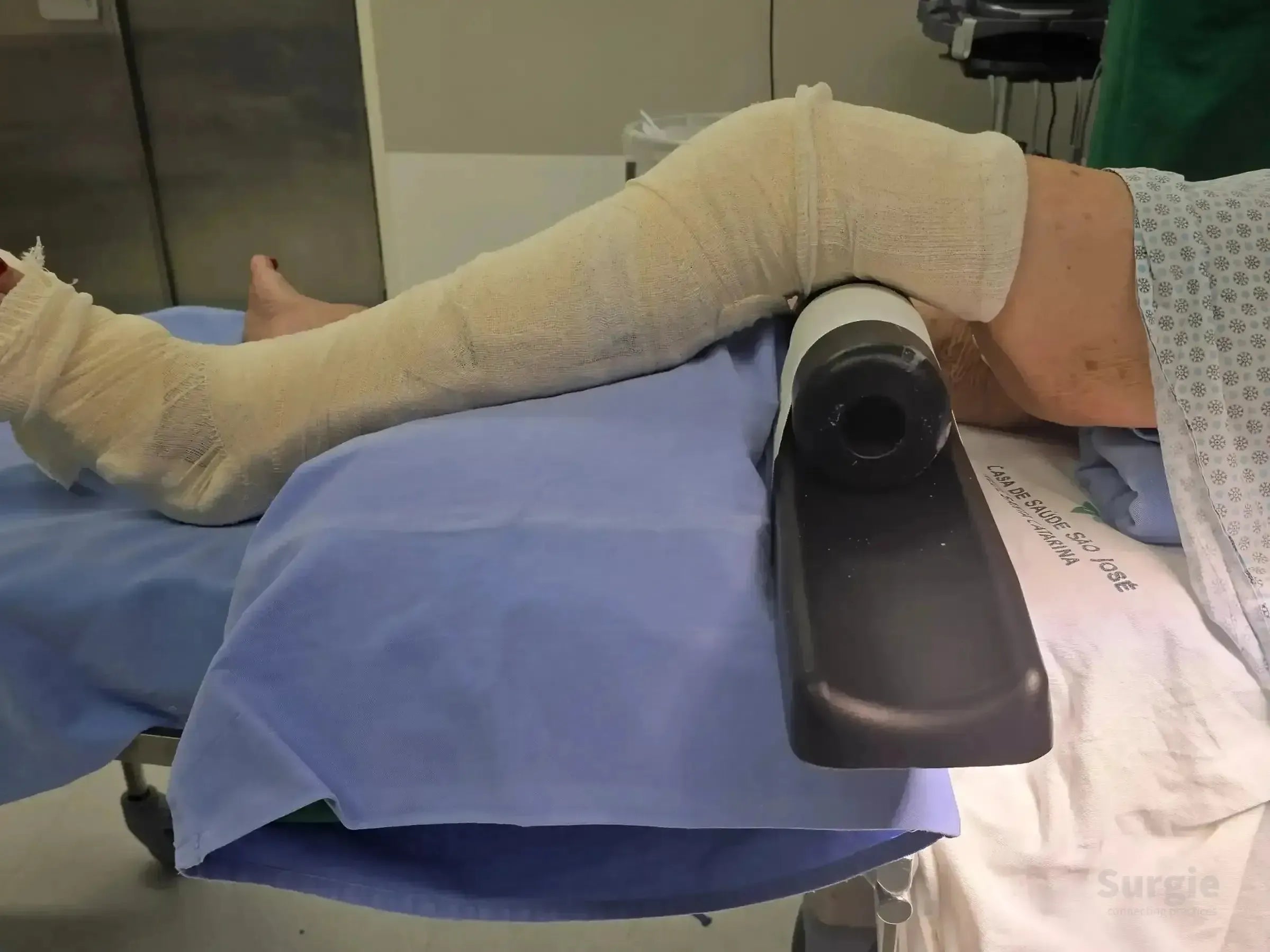 Patient leg in beige compression wrap positioned on a surgical support for suprapatellar intramedullary nail surgery.
