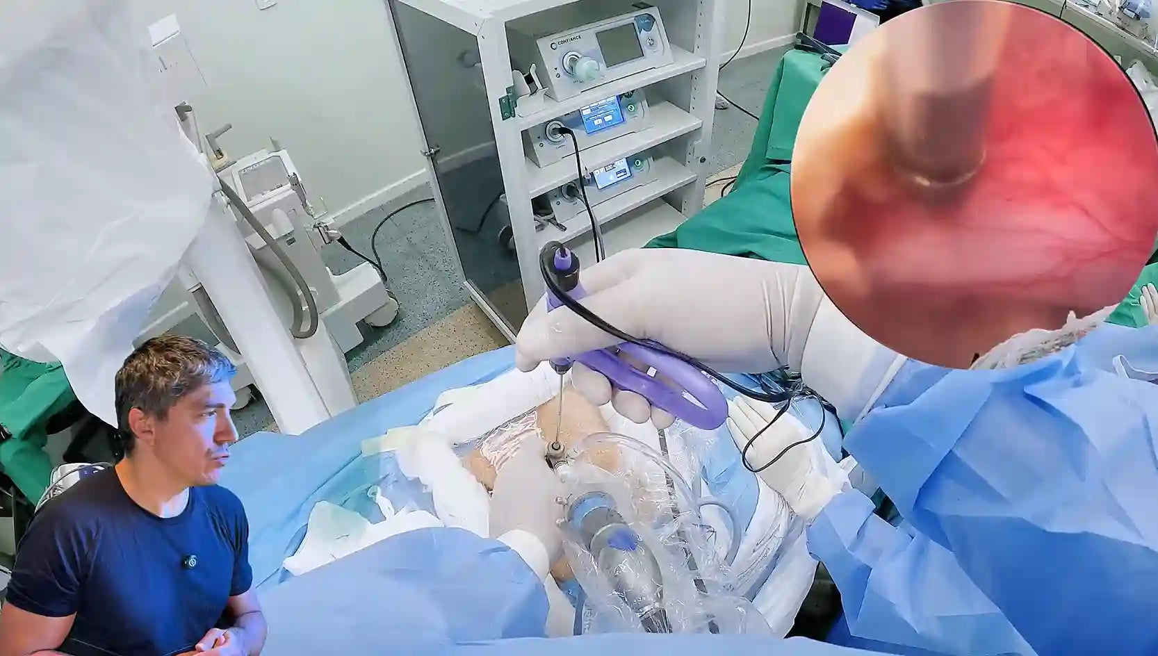 Hérnia L4-L5: Técnica Endoscópica Interlaminar