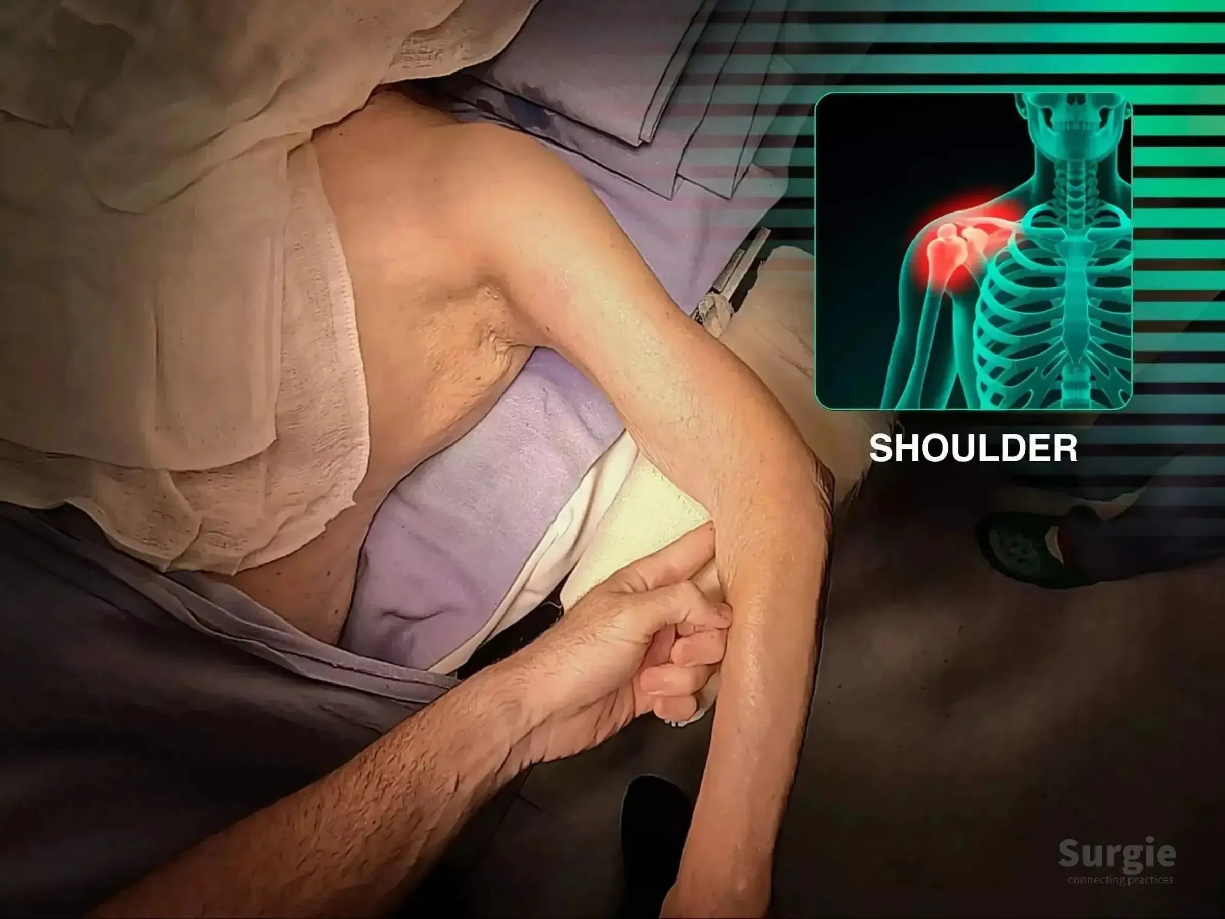 Surgeon performing a deltopectoral approach for a proximal humerus fracture with a shoulder anatomy overlay.
