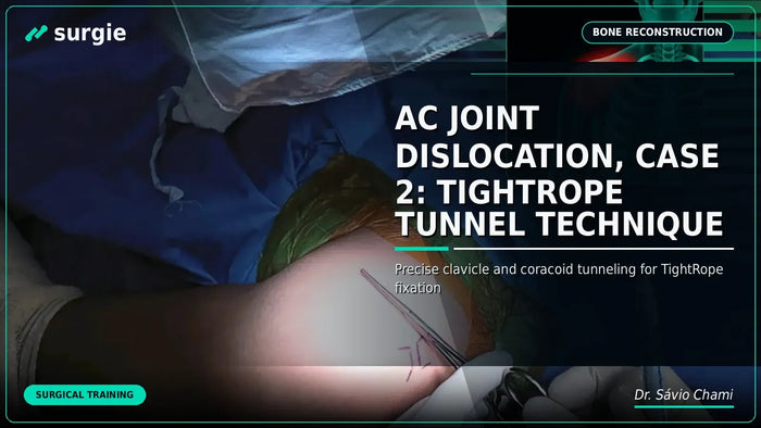 AC Joint Dislocation, Case 2: TightRope Tunnel Technique