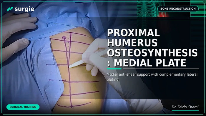 Proximal Humerus Osteosynthesis: Medial Plate